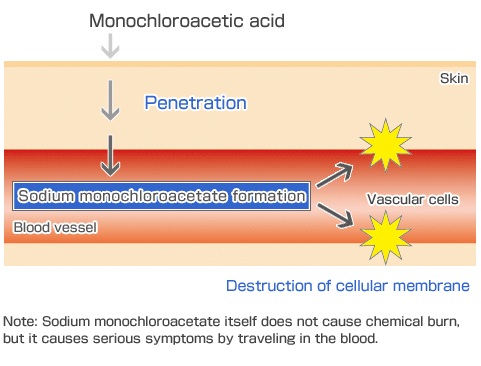 Mechanism of chemical injury